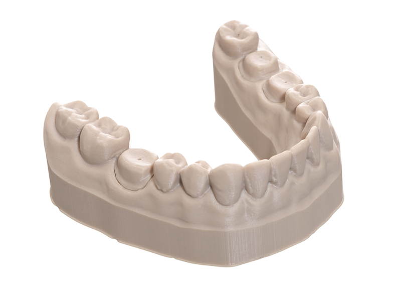 Dental models 3D printed with the xDENT341 resin